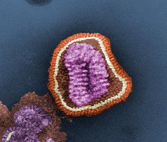 Negative-stained transmission electron micrograph of influenza virus particle, or “virion”. Creative Commons CDC Dr. Erskine. L. Palmer; Dr. M. L. Martin